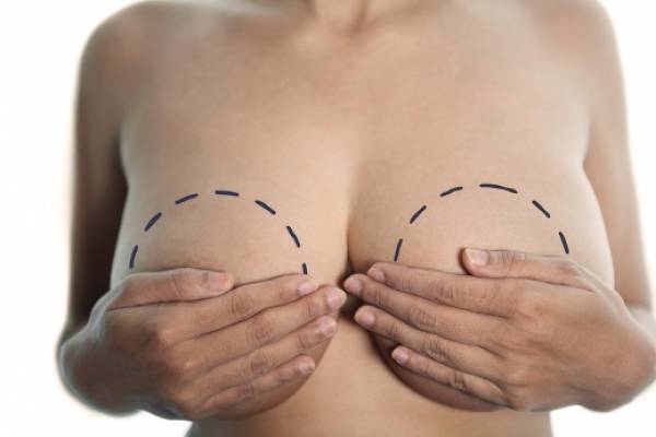 Паказанні да правядзення периареолярной мастопексии